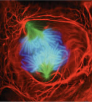 <p>what stage of mitosis?</p>