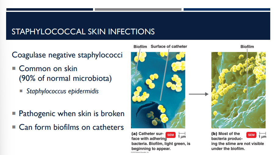 <p>What type of staphylococcal skin infection is common on skin (90% of normal microbiota)?</p>