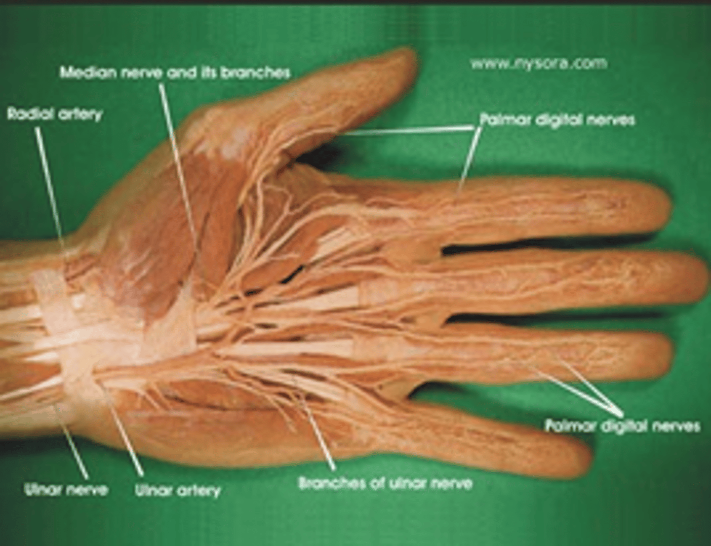 <p>ALWAYS check neurovascular status before any anesthesia</p>