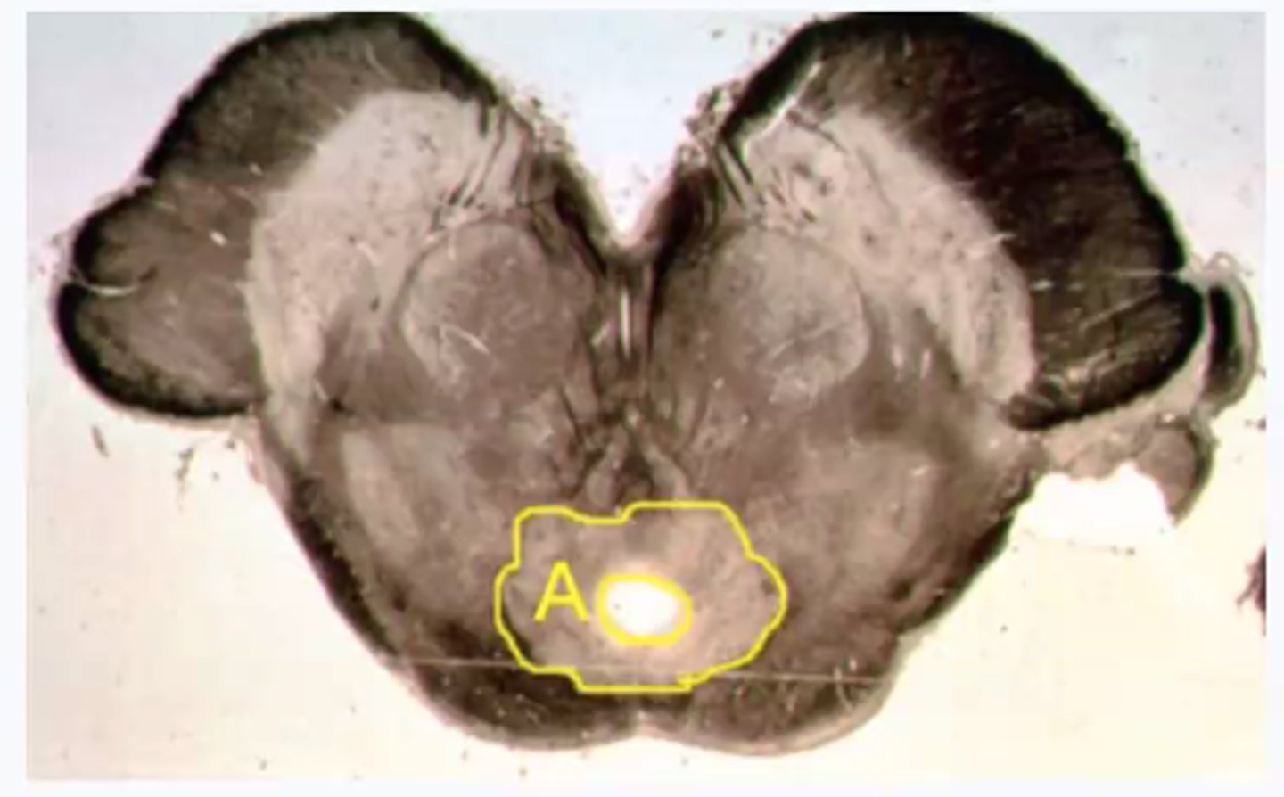 <p>Identify the structures indicated by the outline and letter "A"</p>
