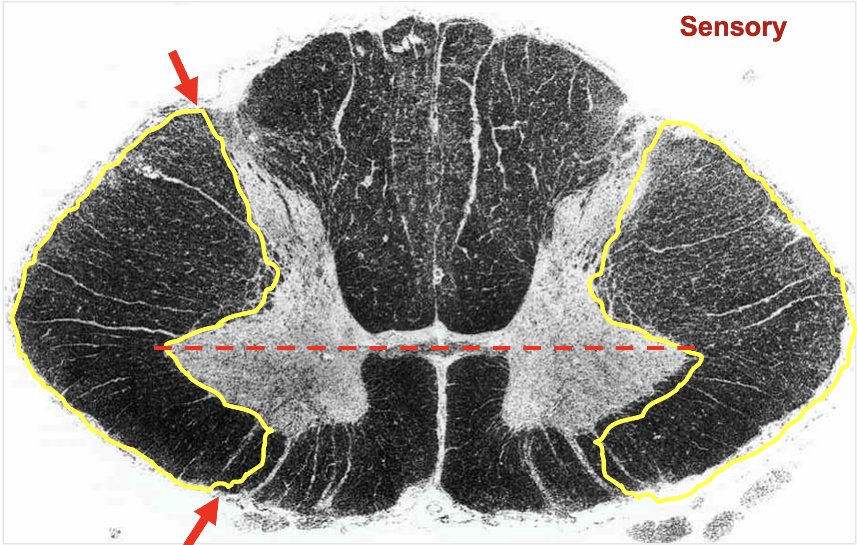 <p>between lateral edge of dorsal and ventral horns; contains multple tracts</p><ul><li><p>sensory and motor tracts </p></li><li><p>ascending and descending tracts </p></li></ul><p></p>