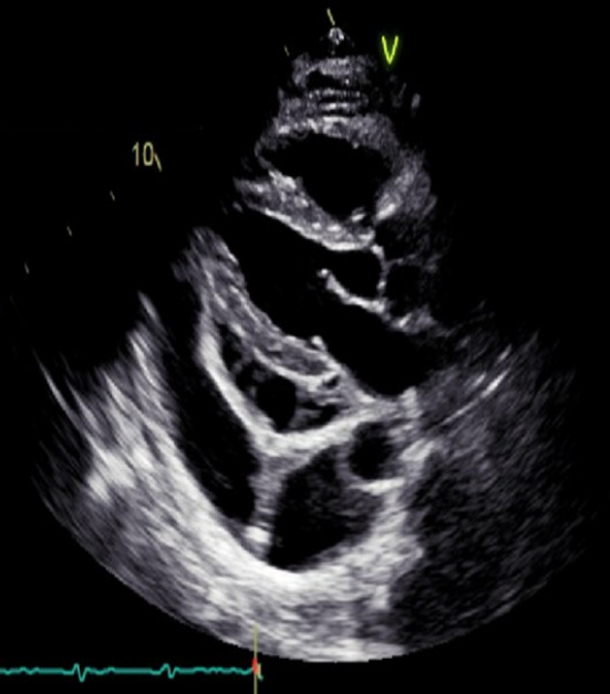 <p>Identify this image. </p>