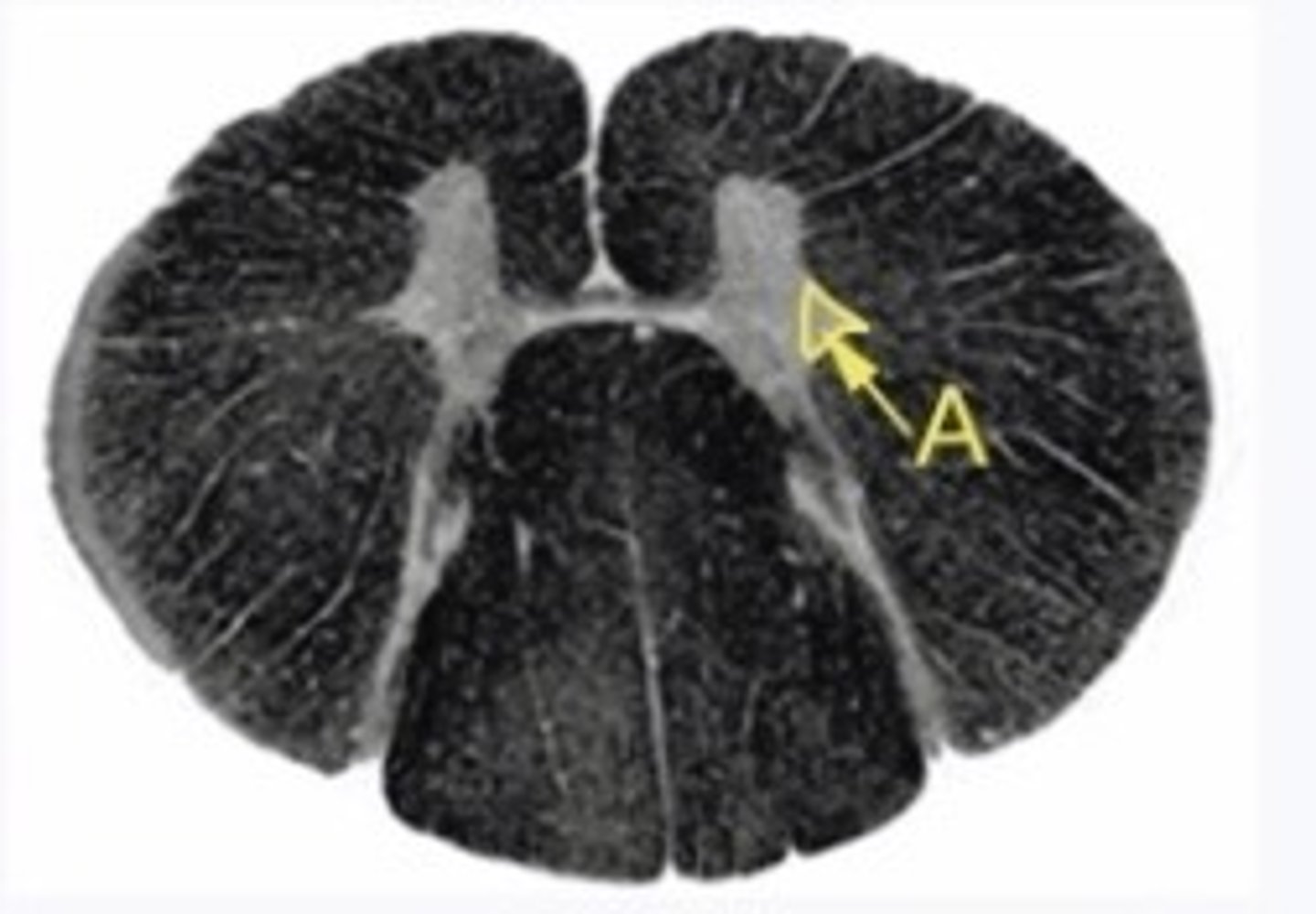 <p>What type of neurons are found in the structure "A."</p>