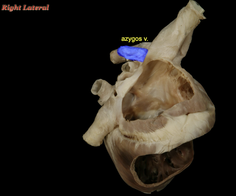 <p>Azygos v. (ca)</p>