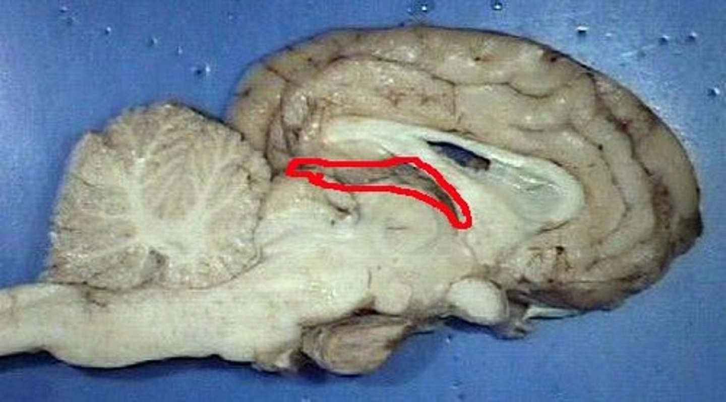 <p>found in each ventricle</p>