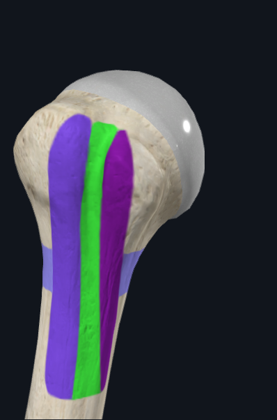 <p>What is this part of the humerus called</p>