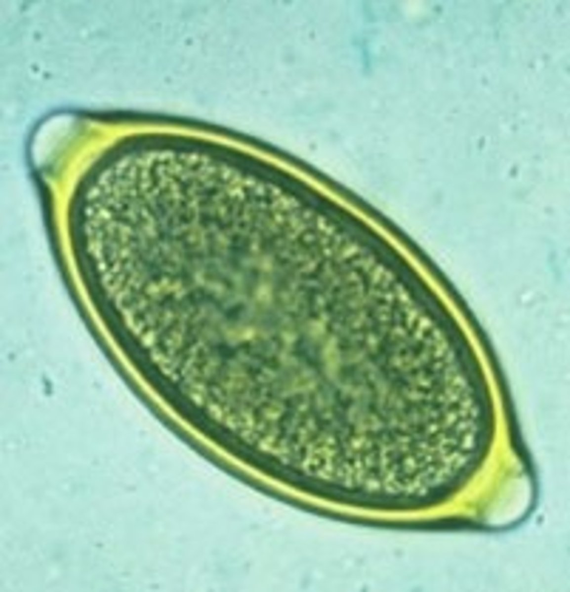 <p>This was found in a stool sample of a dog with black tarry stool. What is it?</p>