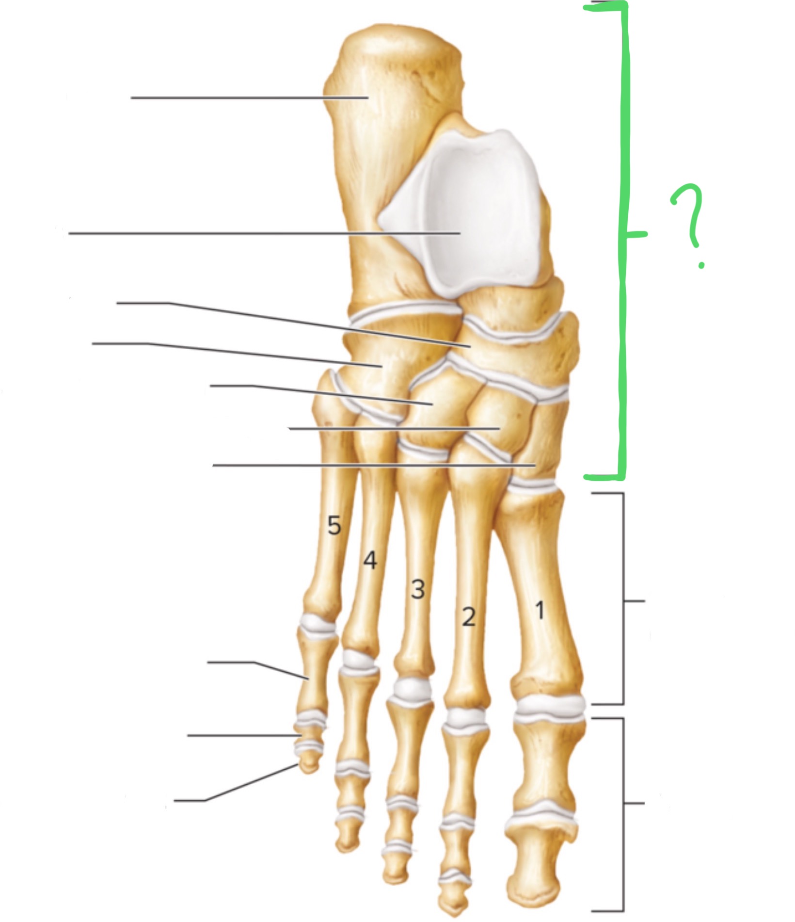 <p>What bone is this?</p>