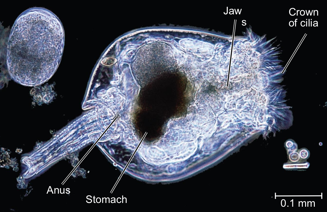 <p>Rotifere (phylum Rotifera) </p>