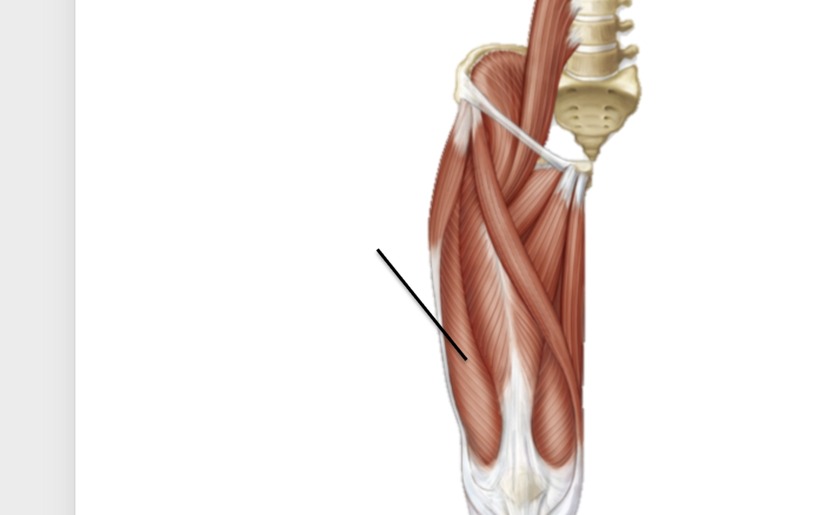<p>What muscle is this?</p>