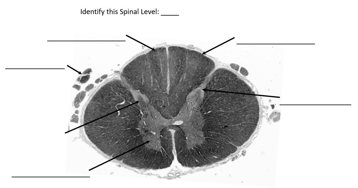 <p>identify this spinal level</p>