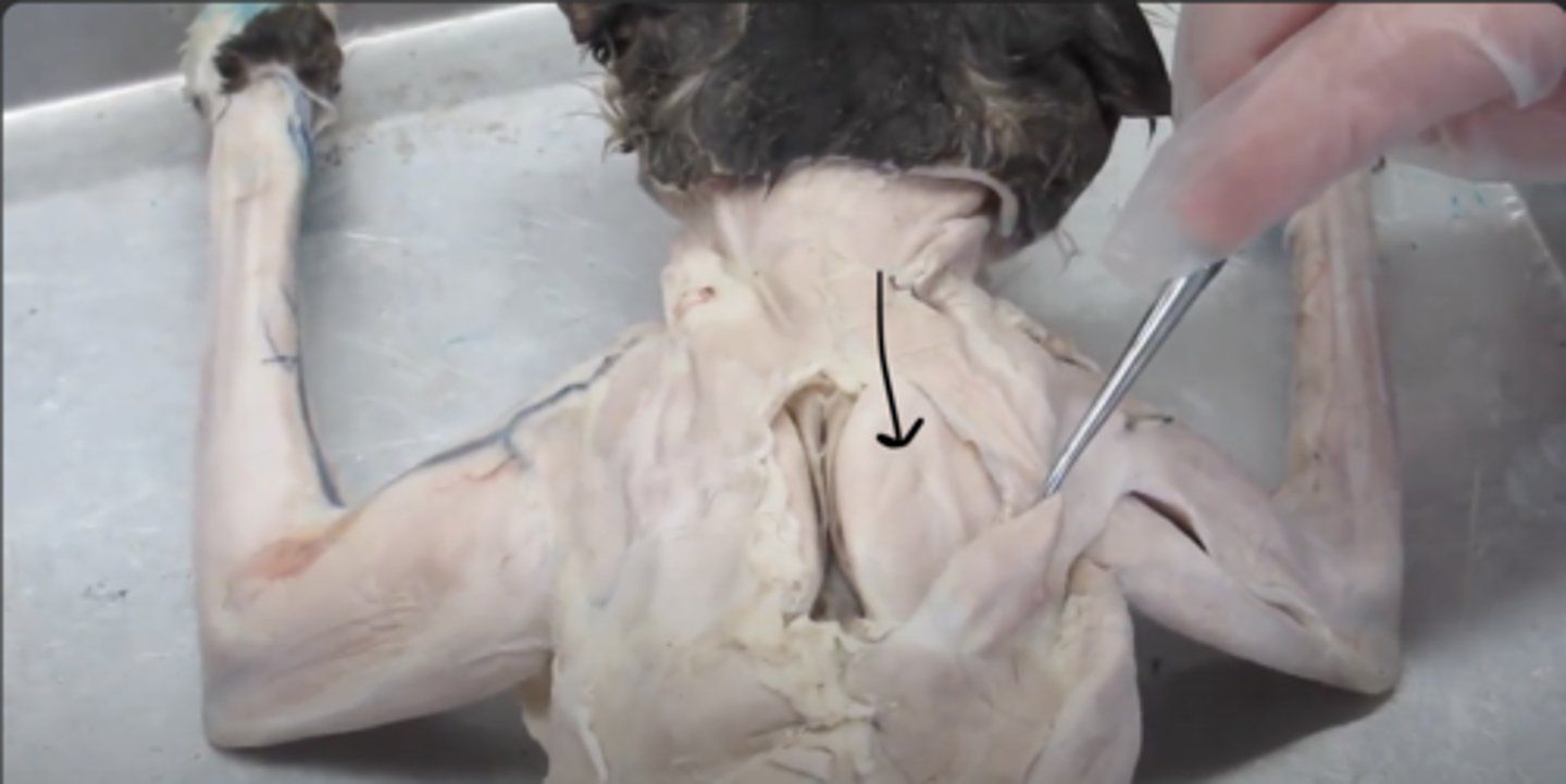 <p>name this muscle</p>