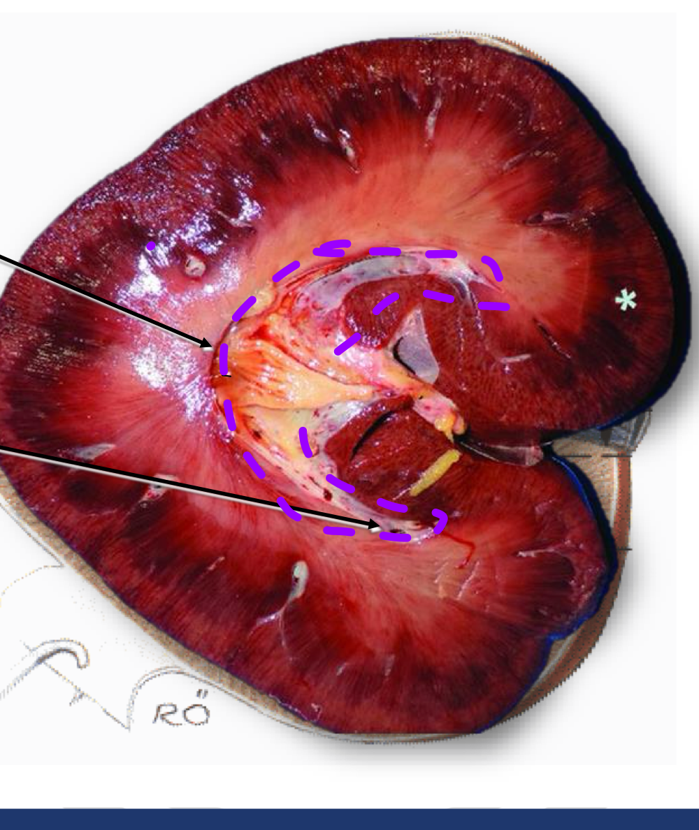 <p>Unlike the canine, In the equine they do not have the projections like (Renal Recess) collecting duct that drain urine from the medulla of the kidney into the renal pelvis</p>