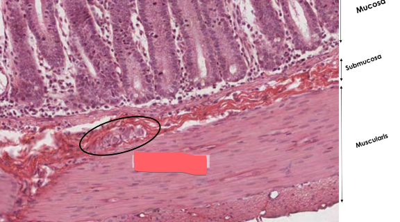 <ul><li><p>in the submucosa</p></li><li><p>activates glands</p></li><li><p>innervates layer of smooth muscle that squeezes mucosa and coaxes out secretions</p></li></ul><p></p>