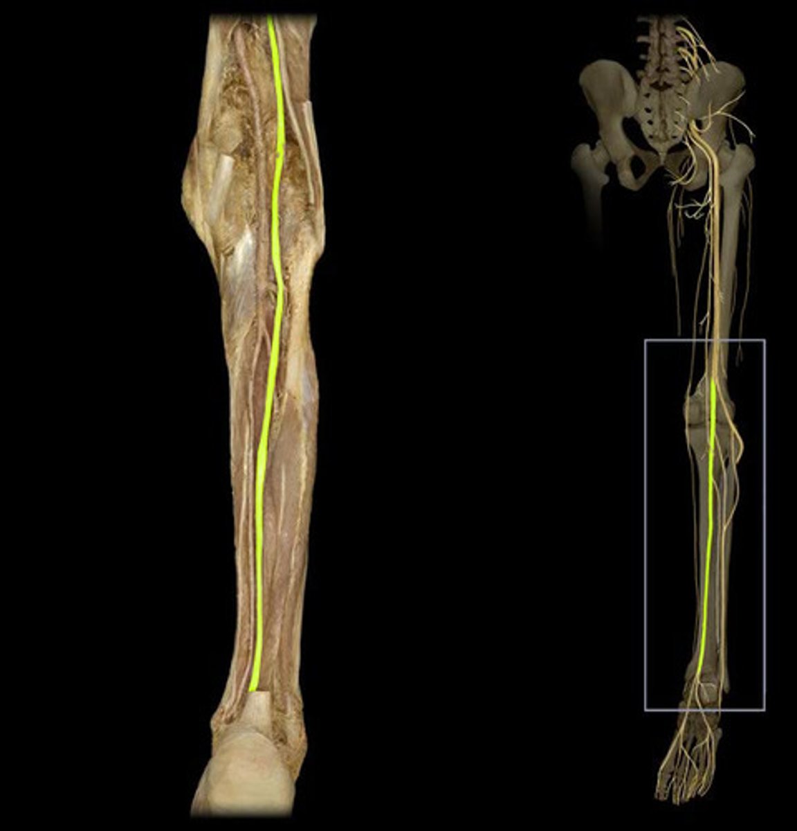 <p>Posterior to the tibialis posterior and flexor digitorum longus, passing under the flexor retinaculum. Innervates the posterior leg and sole of foot.</p>