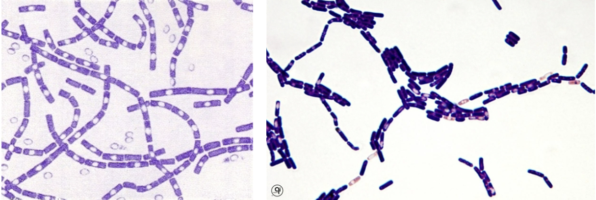 <p>commonly found in soil. aerobic gram positive rod. spores are formed when organism is present in environment (no spores in vivo). important species: anthracis, cereus</p>