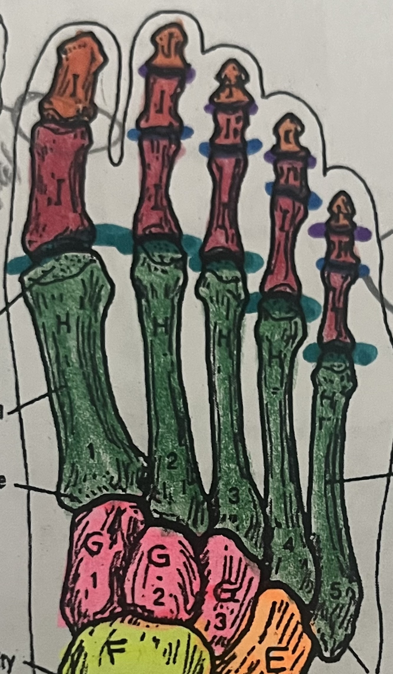 <p>what are the purple lines?</p>