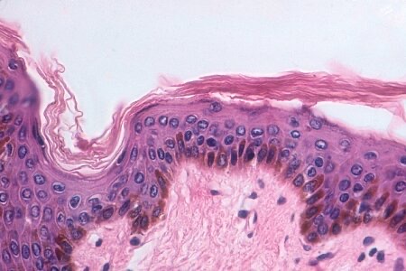 <p>Stratified Squamous Epithelium (Keratinized)</p>