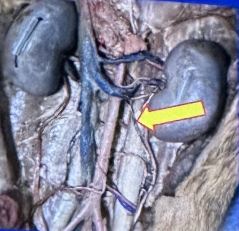 <p>What is this vein in a dissection of a dog’s abdomen? be specific </p>