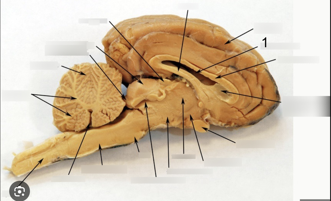 <p>What structure of the brain is this? #1</p>