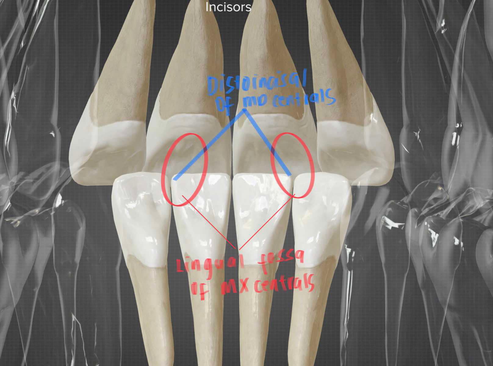 <p>MX central incisors only — Distoincisal aspect of MD central opposes the lingual fossa of MX central</p><p>Explanation: </p><p>During <strong>protrusion</strong>, the <strong>mandibular central incisors</strong> contact only the <strong>maxillary central incisors</strong>, with the distoincisal aspect of the mandibular centrals opposing the lingual fossa of the maxillary centrals.</p><p>In <strong>lateral protrusion</strong>, this contact may also extend to the <strong>maxillary lateral incisors</strong> depending on the direction of movement.</p>