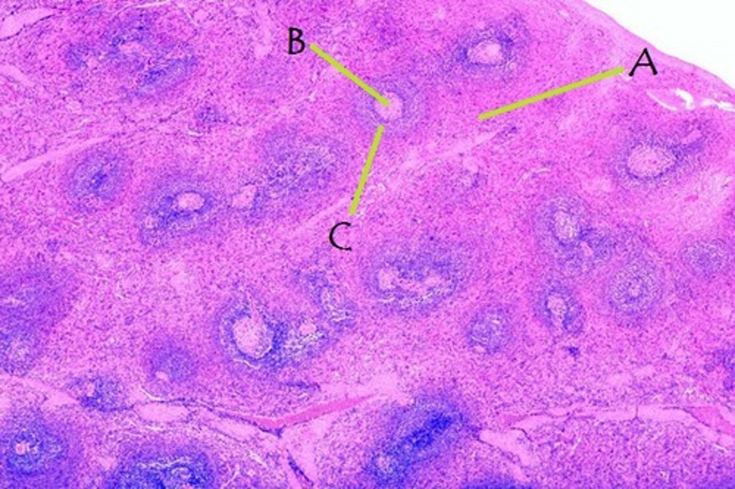 <p>Identify A</p>