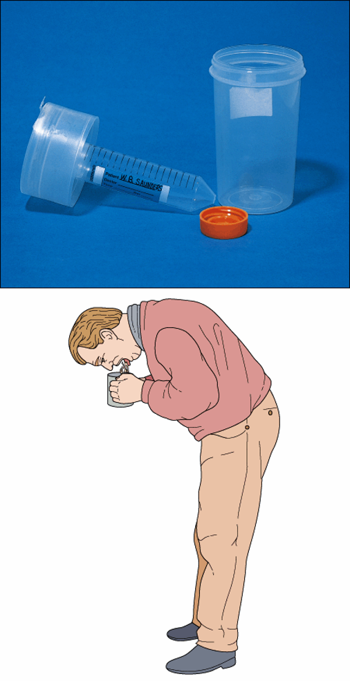 <p>by expectoration or tracheal suctioning to assist in identification of organisms or abnormal cells</p>