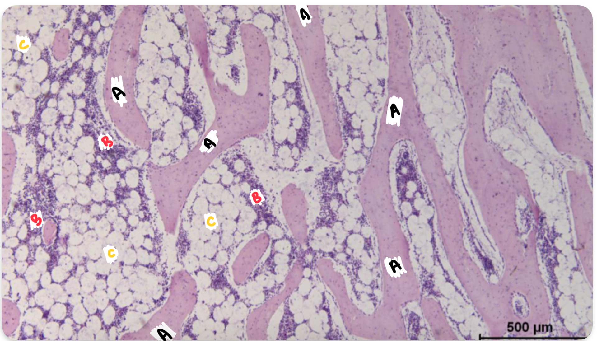 <p>What part of the long bone is labelled A?</p>