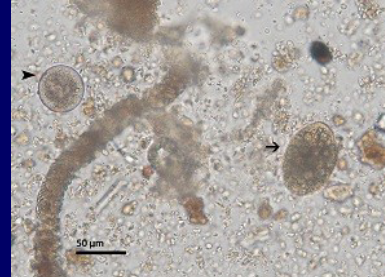 <p>Movement derived from cilia (shorter and numerous)</p>