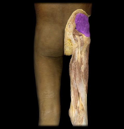 Abduction of thigh (non weight-bearing)
Lowers pelvis on weight-bearing side