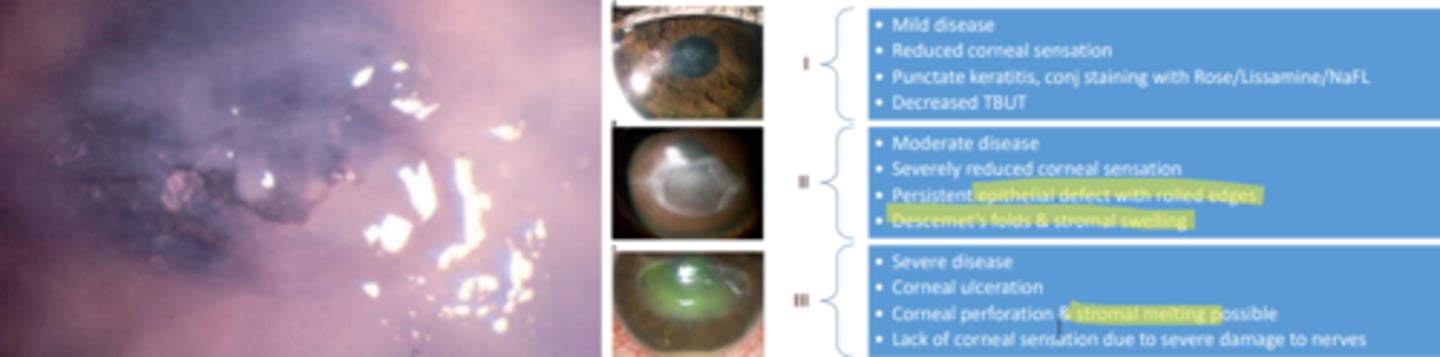 <p>condition caused by partial or complete loss of trigeminal innervation to the cornea that leads to decreased corneal sensation and subsequent breakdown of corneal epithelium and loss of vision. Is very rare, but prevalence depends on the underlying cause. Treatment is dependent on the stage of disease, but all topical drops that contain preservatives should be discontinued. A prophylactic antibiotic should be employed.</p>