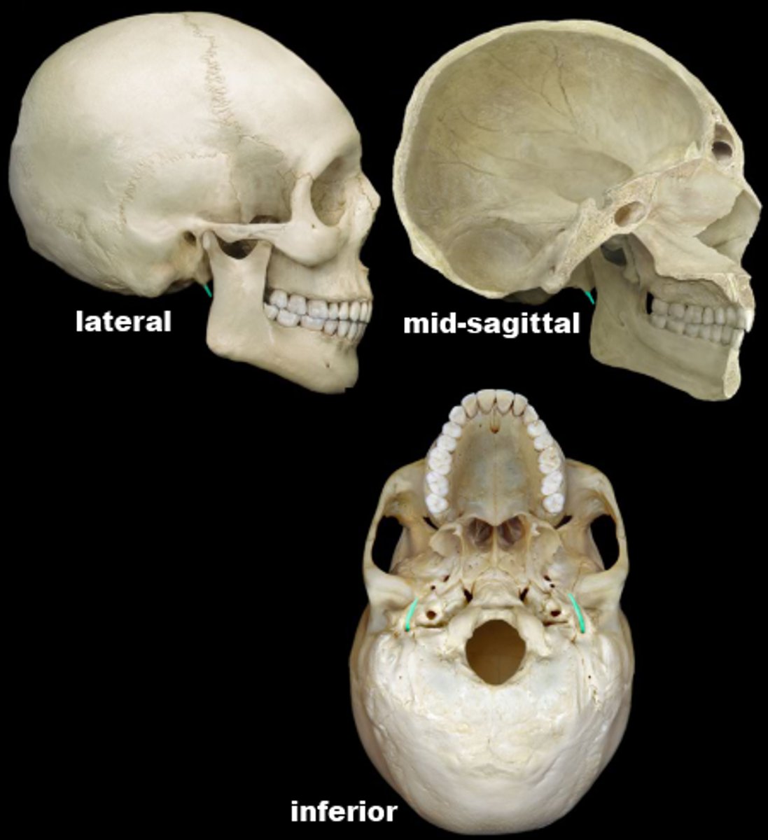 knowt flashcard image