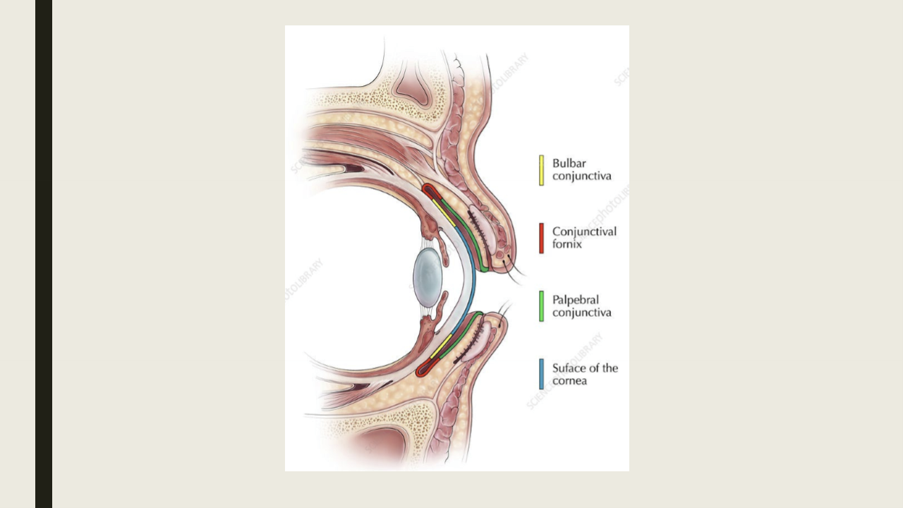 <ul><li><p>Palpebral: starts at MCJ and attaches to posterior tarsal plate</p></li><li><p>Forniceal: loose and redundant conj that folds on itself</p></li><li><p>Bulbar: covers anterior sclera and is continuous</p></li></ul><p></p>