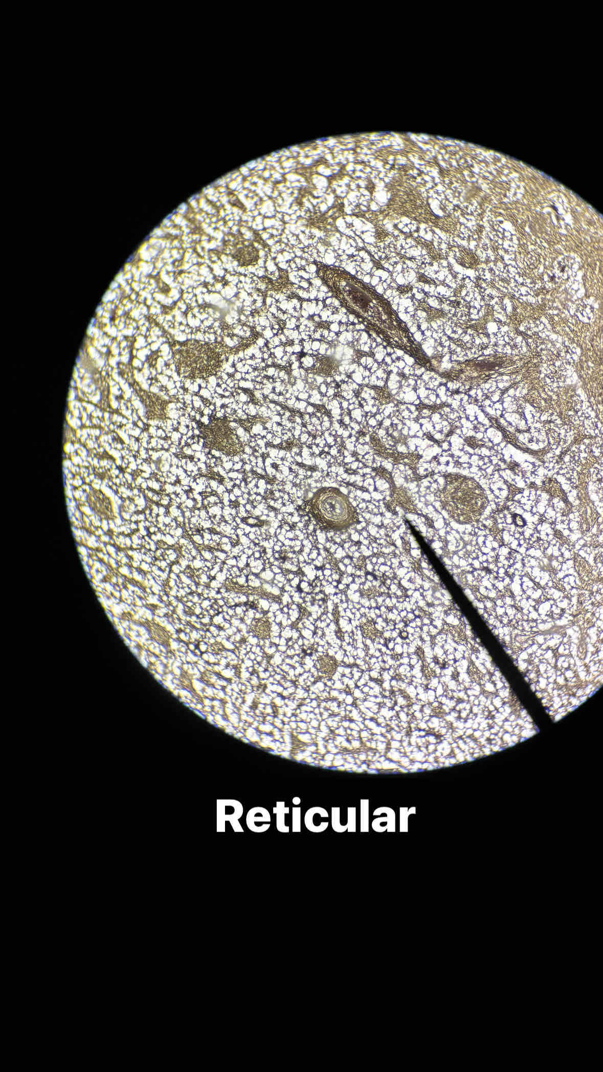 <p>type and subtype tissue? </p>