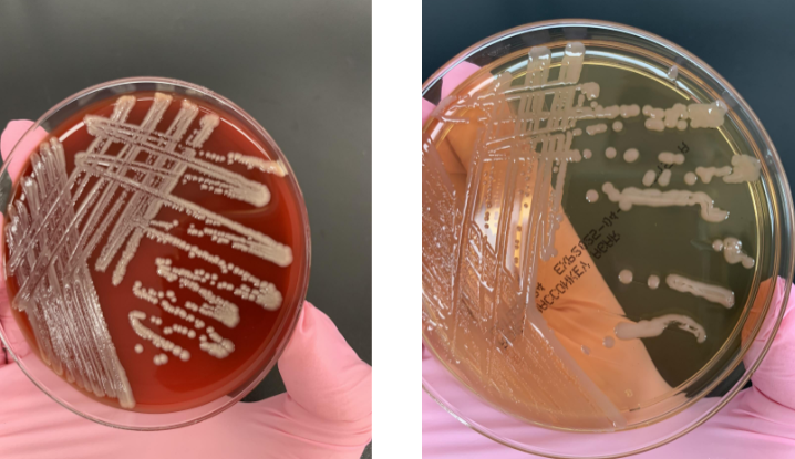 <p>lets say your plate showed a GNCB that was oxidase (-), and nomotile but on the API strip it showed glucose (+), what organism is this</p>