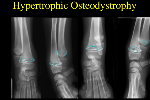 <p>Hypertrophic Osteodystrophy</p>