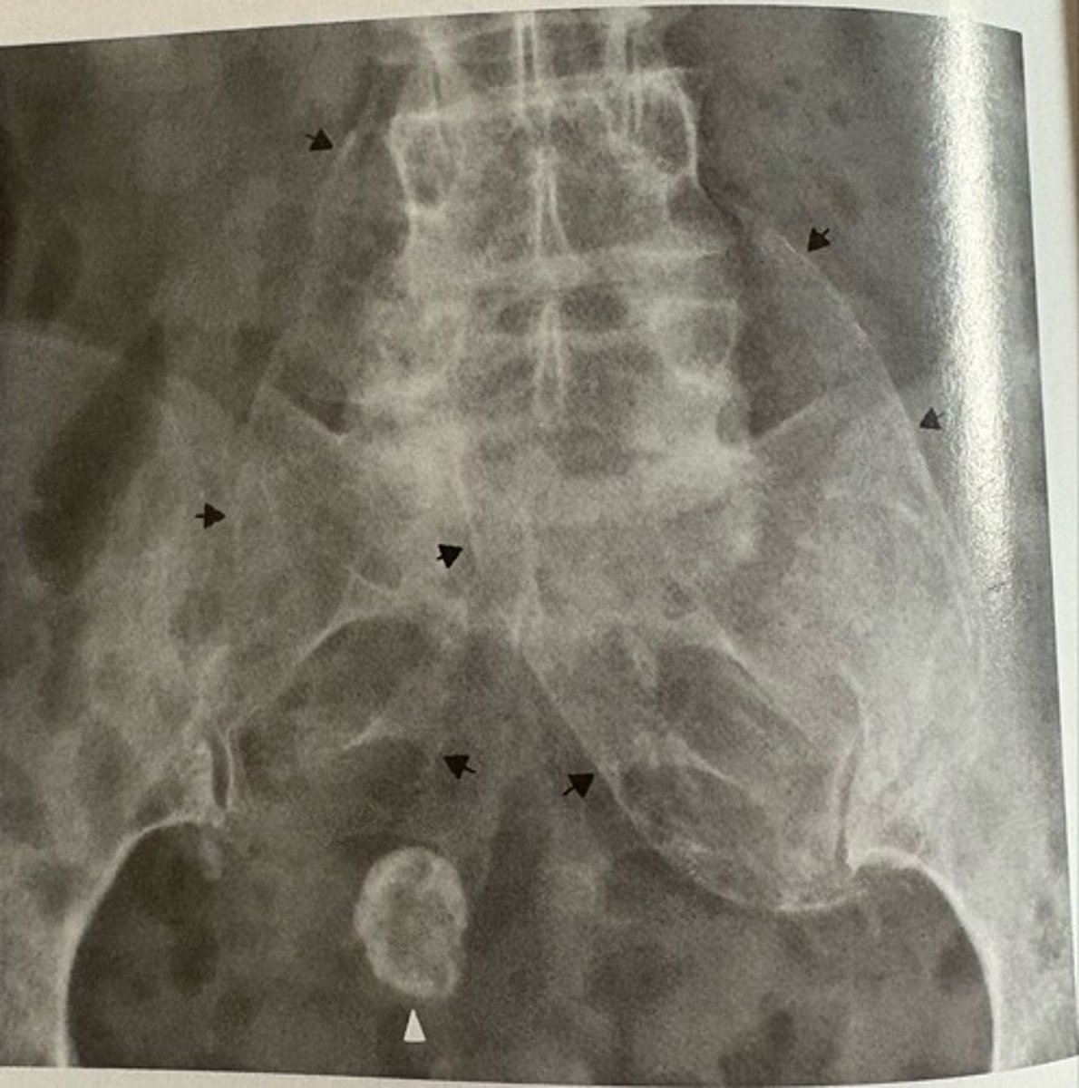 <p>what pathology is present?</p>