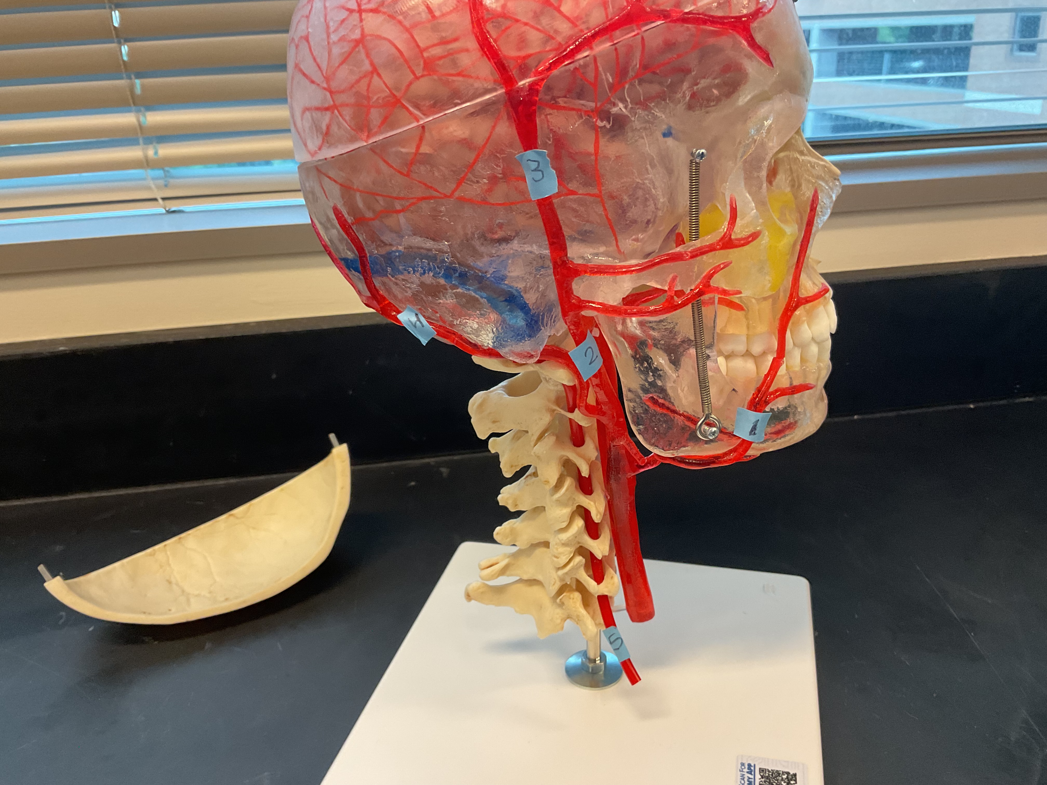 <p>What is the artery labeled #1?</p>