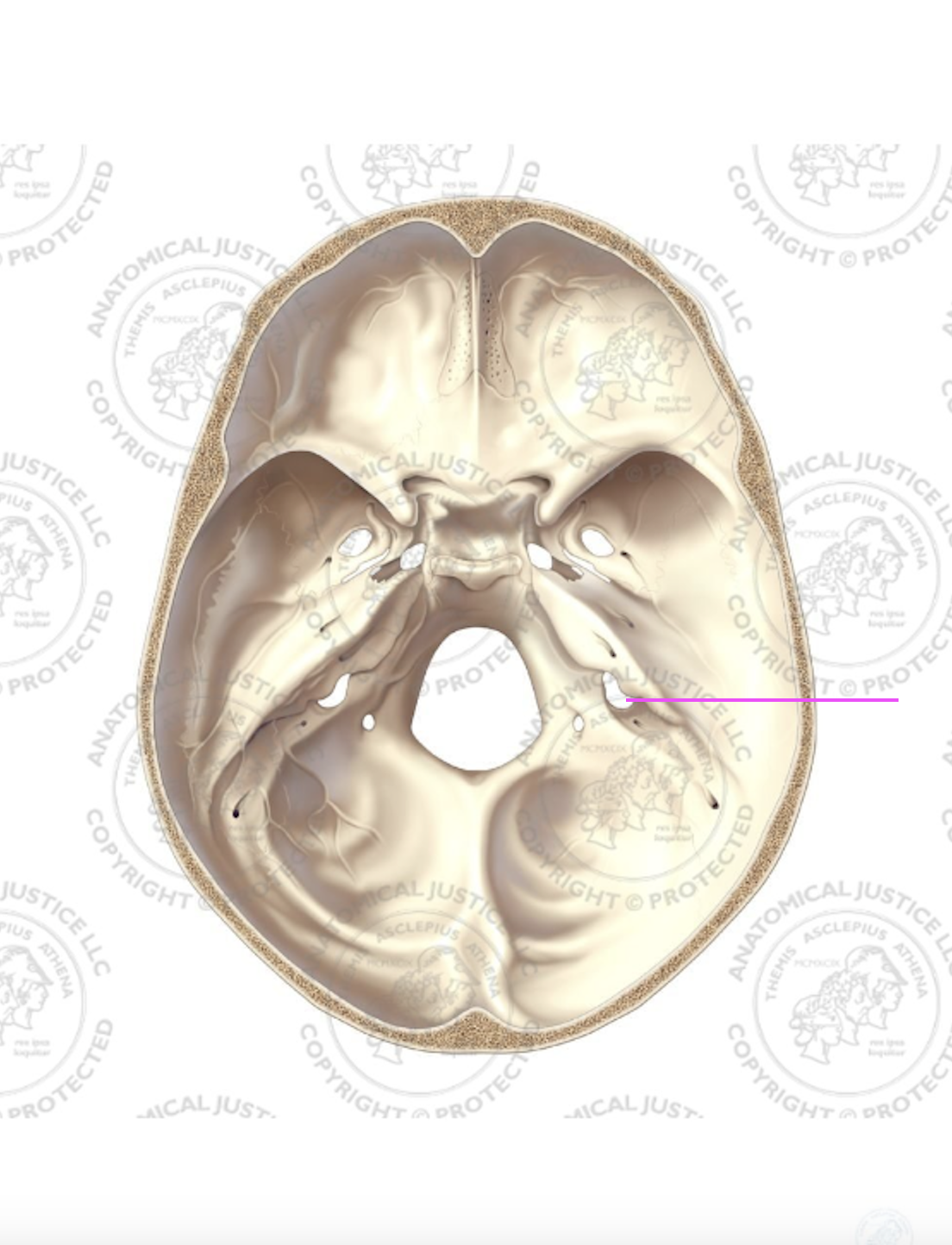 <p>What bone marking is this?</p>