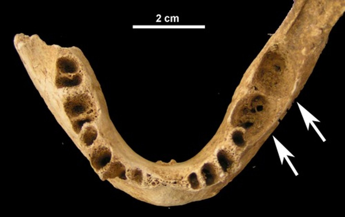 <p>tooth sockets</p>