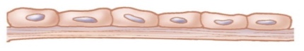 <p>What cellular adaptation is this?</p>