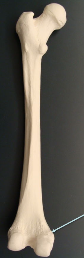 <p>Medial epicondyle&nbsp;</p>