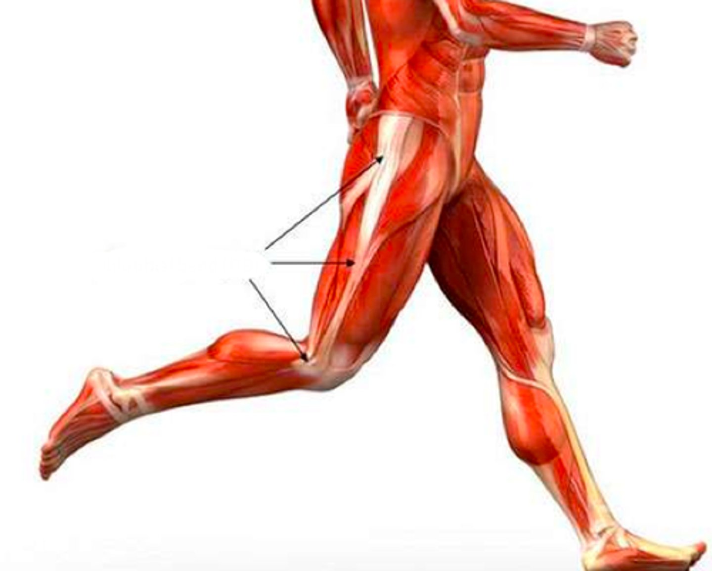 <p>This structure is called the ___________ tract [band, or fascia.]</p>