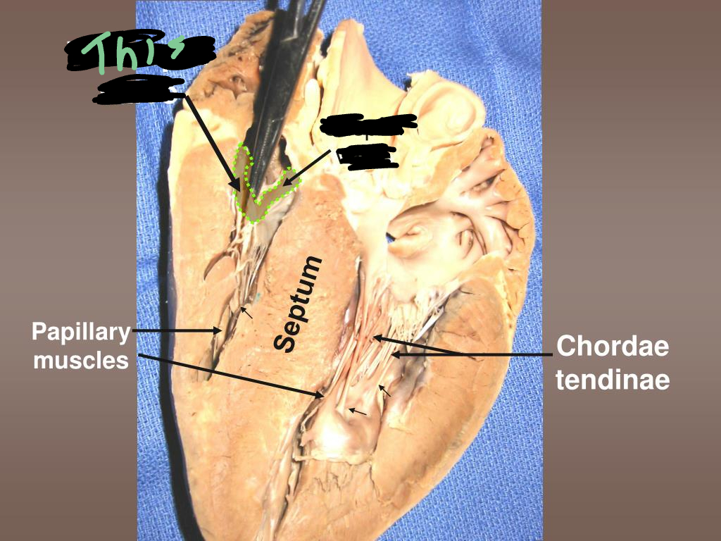term image