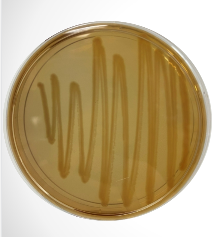 <p>What agar is used in this test? What bacteria was used and what does the reaction suggest?</p>