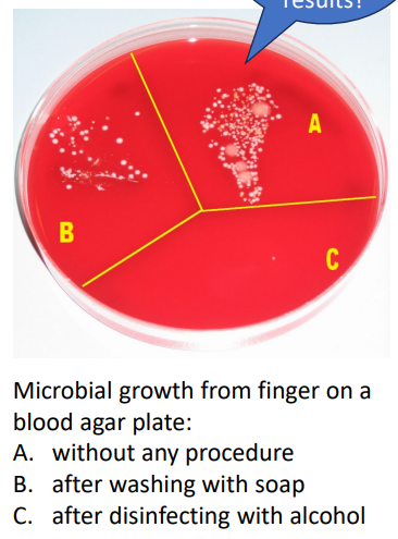 <p>FOR NON-LIVING MATERIALS: DISINFECTANTS:</p><p>- Bleach (chlorine) - bactericidal, forms an acid when added to water, surface cleaner and swimming pool and drinking water treatment</p><p>- alcohol - kills by denaturing proteins and disrupting microbial cell membranes (bacteria, fungi, enveloped viruses) on surfaces</p><p>FOR LIVING TISSUE: ANTISEPTICS: (basically this is for when u wanna clean on skin)</p><p>- Iodine - binds amino acids of enzymes to inhibit activity, also binds fatty acids in microbial cell membranes</p><p>- Phenol - denatures proteins, listerine named after Joseph Lister who first applied phenol to bandages to control infection</p><p>- Alcohol - also effective on skin, but not open wounds as it congeals host proteins</p><p>- soaps, detergents disrupt microbial adherence, can kill through disruption</p>