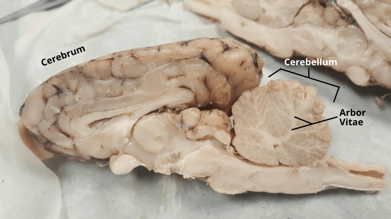 <p>white matter </p>