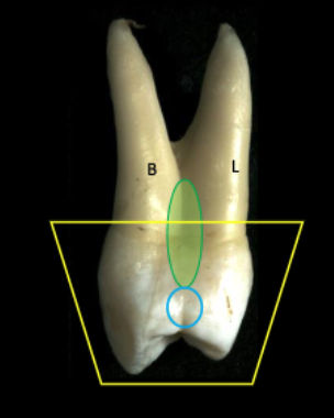 <p>mesial marginal ridge developmental groove</p>
