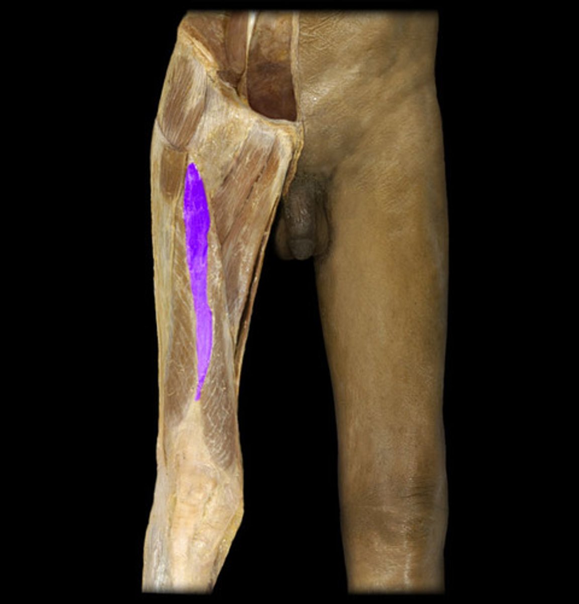 <p>Origin: Anterior femoral shaft</p><p>Insertion: Patellar ligament to tibial tuberosity</p>