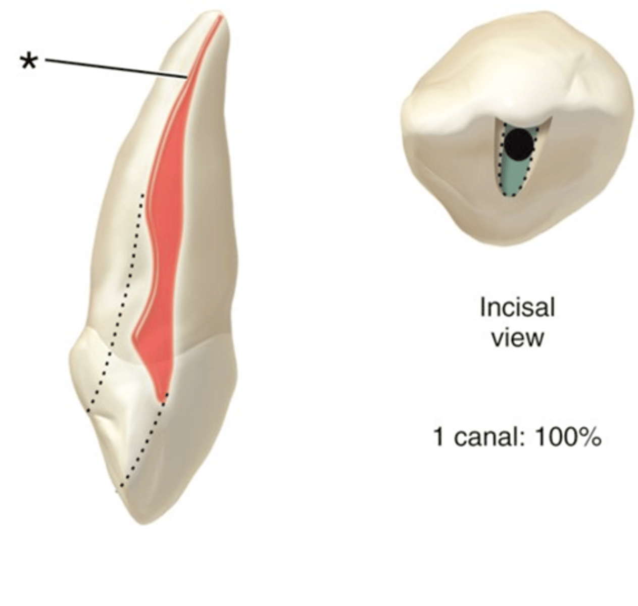 <p>maxillary canine access shape</p>